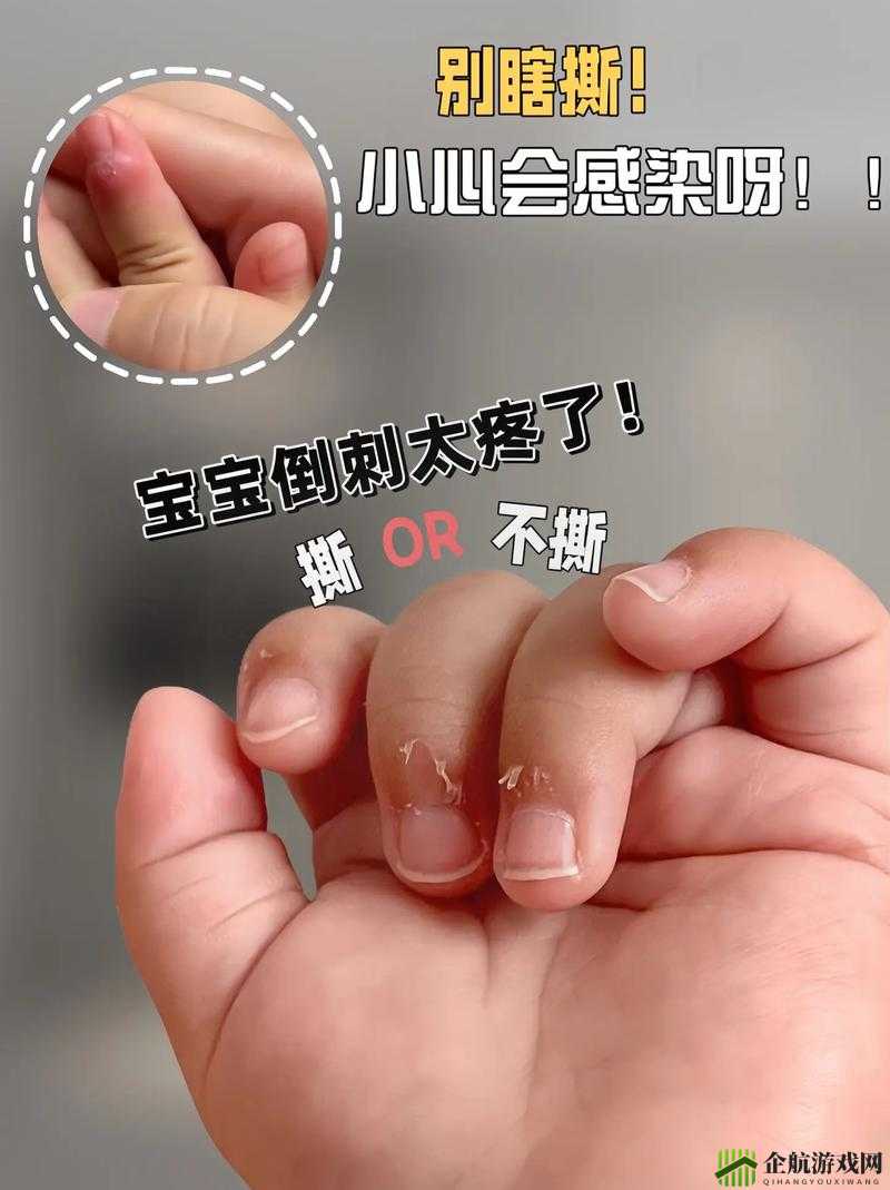 宝宝手指痛的原因是什么：仅三根手指疼痛