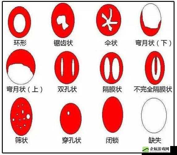 阴脣肥大图示蝴蝶的独特魅力